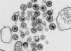 microscopy image of HIV particles