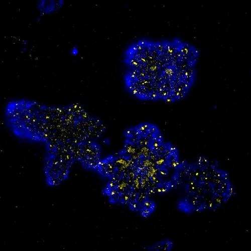Microscopy image of T cells with chimeric antigen receptors. Different elements are fluorescently tagged; a negative regulator in blue, and a recruited enzyme in yellow
