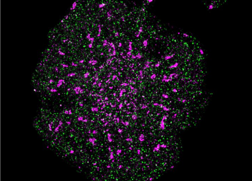 Image of a T cell showing T cell receptors (pink) and CD45 (green)