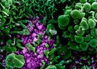 Colourised scanning electron micrograph of a cell heavily infected with SARS-CoV-2 virus particles
