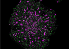 Image of a T cell showing T cell receptors (pink) and CD45 (green)