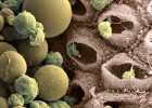 Scanning electron micrograph of milk producing cells having just secreted milk fats and proteins